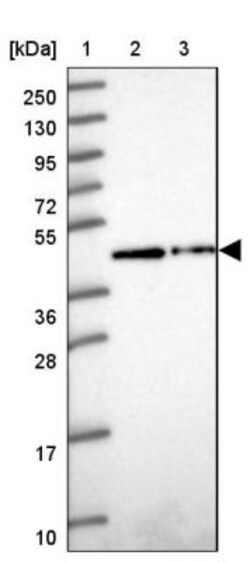 ZNF852 Antibody, Novus Biologicals:Antibodies:Primary Antibodies