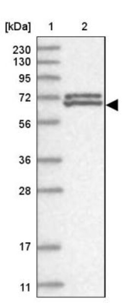 ZNF8 Antibody, Novus Biologicals 0.1mL; Unlabeled:Antibodies, Polyclonal