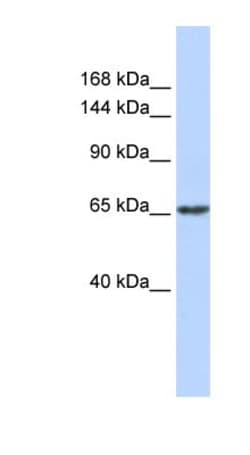 ZNF91 Antibody, Novus Biologicals 100 &mu;L | Buy Online | Novus Biologicals | Fisher Scientific