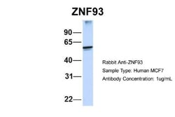ZNF93 Antibody, Novus Biologicals 20 &mu;L | Buy Online | Novus Biologicals | Fisher Scientific