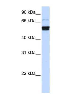 ZNF93 Antibody, Novus Biologicals 20 &mu;L | Buy Online | Novus Biologicals | Fisher Scientific