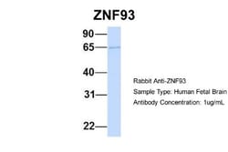 ZNF93 Antibody, Novus Biologicals 20 &mu;L | Buy Online | Novus Biologicals | Fisher Scientific
