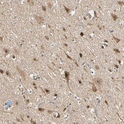 ZNF96 Antibody, Novus Biologicals 0.1mL; Unlabeled:Antibodies, Polyclonal