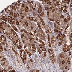 ZNFN1A4 Antibody, Novus Biologicals:Antibodies:Primary Antibodies