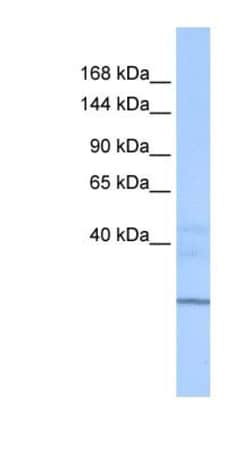 ZNHIT1 Antibody, Novus Biologicals 100&mu;L; Unlabeled:Antibodies, Polyclonal