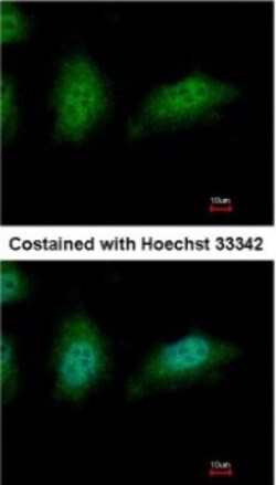 ZNHIT2 Antibody, Novus Biologicals 0.1mL; Unlabeled:Antibodies, Polyclonal