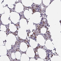 ZNHIT2 Antibody, Novus Biologicals 0.1mL; Unlabeled:Antibodies, Polyclonal