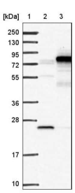 ZNHIT6 Antibody, Novus Biologicals 0.1mL; Unlabeled:Antibodies, Polyclonal