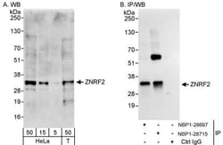ZNRF2 Antibody, Novus Biologicals 0.1mg; Unlabeled:Antibodies, Polyclonal
