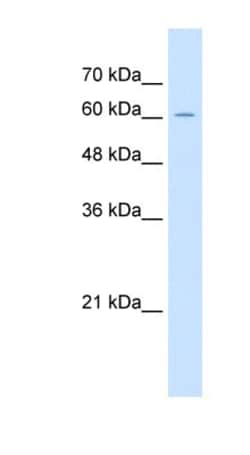 ZP2 Antibody, Novus Biologicals:Antibodies:Primary Antibodies