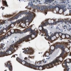 ZP2 Antibody, Novus Biologicals:Antibodies:Primary Antibodies