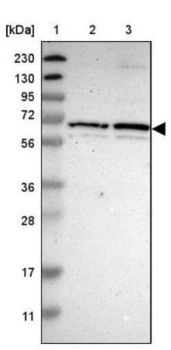 ZP2 Antibody, Novus Biologicals:Antibodies:Primary Antibodies