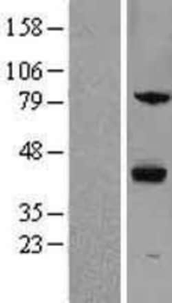 Novus Biologicals™ ZPBP Overexpression Lysate