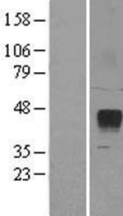 Novus Biologicals™ ZPBP2 Overexpression Lysate