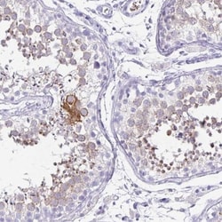 ZPBP2 Antibody, Novus Biologicals 25 &mu;L, Unlabeled:Antibodies, Polyclonal