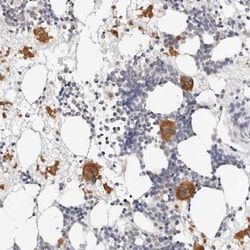 ZRANB1/Trabid Antibody, Novus Biologicals 0.1mL; Unlabeled:Antibodies,