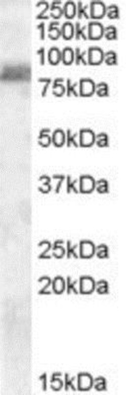 ZRANB1/Trabid Antibody, Novus Biologicals 0.1mg; Unlabeled:Antibodies,