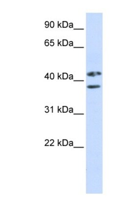 ZRANB2 Antibody, Novus Biologicals 100&mu;L; Unlabeled:Antibodies, Polyclonal