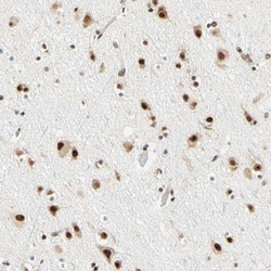 ZSCAN16 Antibody, Novus Biologicals 0.1mL; Unlabeled:Antibodies, Polyclonal