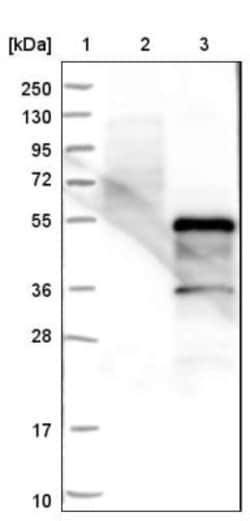 ZSCAN16 Antibody, Novus Biologicals 0.1mL; Unlabeled:Antibodies, Polyclonal