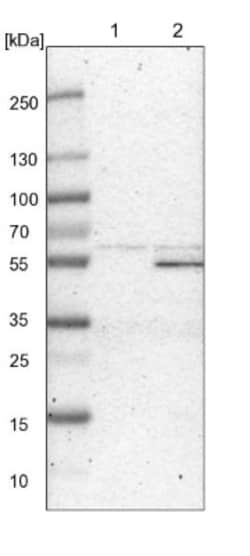 ZSCAN21/ZFP38 Antibody, Novus Biologicals:Antibodies:Primary Antibodies