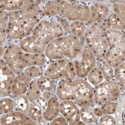 ZSCAN21/ZFP38 Antibody, Novus Biologicals:Antibodies:Primary Antibodies