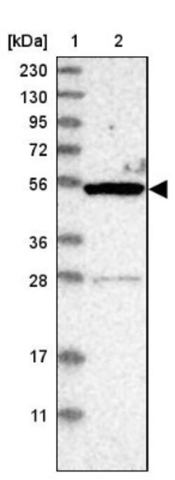 ZSCAN21/ZFP38 Antibody, Novus Biologicals:Antibodies:Primary Antibodies