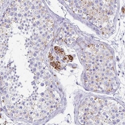 ZSCAN5B Antibody, Novus Biologicals 0.1mL; Unlabeled:Antibodies, Polyclonal