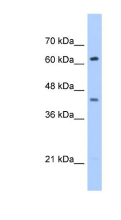 ZSCAN5D Antibody, Novus Biologicals 0.05mg; Unlabeled:Antibodies, Polyclonal