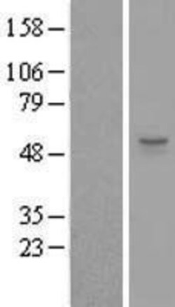 Novus Biologicals&trade;&nbsp;ZSWIM1 Overexpression Lysate