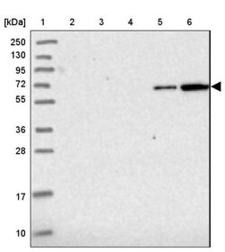 ZSWIM1 Antibody, Novus Biologicals 25 &mu;L, Unlabeled:Antibodies, Polyclonal