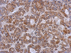 ZSWIM2 Antibody, Novus Biologicals 0.1mL; Unlabeled:Antibodies, Polyclonal