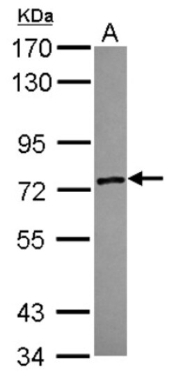 ZSWIM2 Antibody, Novus Biologicals 0.1mL; Unlabeled:Antibodies, Polyclonal