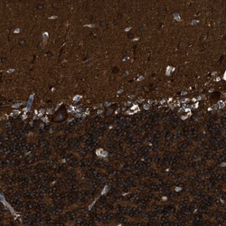 ZSWIM5 Antibody, Novus Biologicals 0.1mL; Unlabeled:Antibodies, Polyclonal