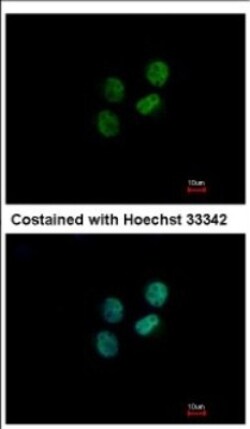 ZWILCH Antibody, Novus Biologicals 0.1mL; Unlabeled:Antibodies, Polyclonal
