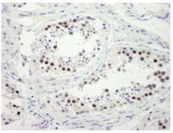 ZWINT Antibody, Novus Biologicals 0.1mL; Unlabeled:Antibodies, Polyclonal