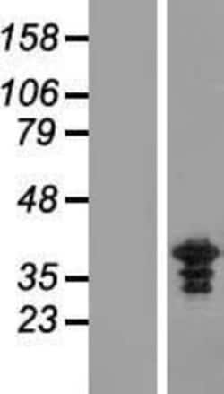 Novus Biologicals&trade;&nbsp;ZWINT Overexpression Lysate
