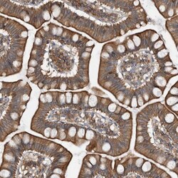 ZWINT Antibody, Novus Biologicals 0.1mL; Unlabeled:Antibodies, Polyclonal