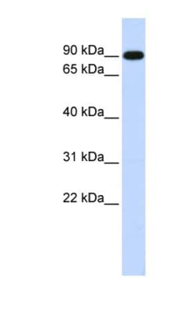 ZXDA Antibody, Novus Biologicals 100&mu;L; Unlabeled:Antibodies, Polyclonal