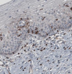 Zyxin Antibody (CL2502), Novus Biologicals 0.1mL; Unlabeled:Antibodies,