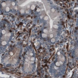 Zyxin Antibody (CL2502), Novus Biologicals 0.1mL; Unlabeled:Antibodies,