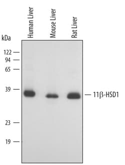 Human/Mouse/Rat 11 beta-HSD1 Antibody, R D Systems 25&mu;g; Unlabeled:Antibodies,