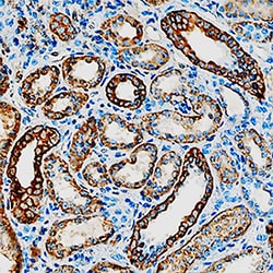 Human 11 beta-HSD2 Antibody, R D Systems 25&mu;g; Unlabeled:Antibodies,