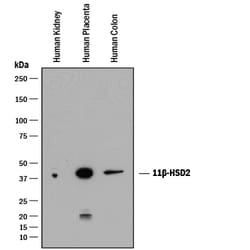 Human 11 beta-HSD2 Antibody, R D Systems 25&mu;g; Unlabeled:Antibodies,