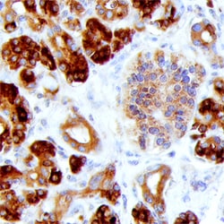 Human Reg1A/B Antibody, R D Systems 25&mu;g; Unlabeled:Antibodies, Monoclonal