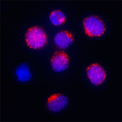 Human GRK5 Antibody, R D Systems 25&mu;g; Unlabeled:Antibodies, Monoclonal