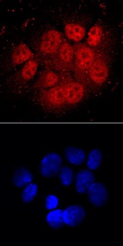 Human ARNT/HIF-1 beta Antibody, R D Systems 25&mu;g; Unlabeled:Antibodies,