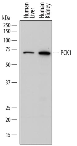 Human PCK1 Antibody, R D Systems 100ug; Unlabeled:Antibodies, Monoclonal