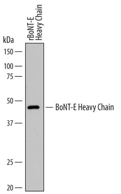C. botulinum BoNT-E Heavy Chain Antibody, R D Systems 25&mu;g; Unlabeled:Anticuerpos