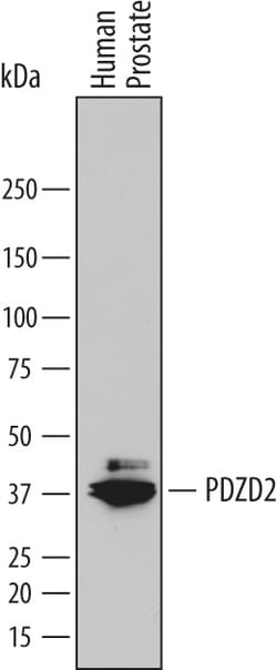 Human PDZD2 Antibody, R D Systems 100ug; Unlabeled:Antibodies, Monoclonal